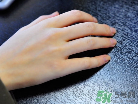 整個手掌都脫皮是什么原因_手掌脫皮怎么辦 整個手掌都脫皮是什么原因_手掌脫皮怎么辦