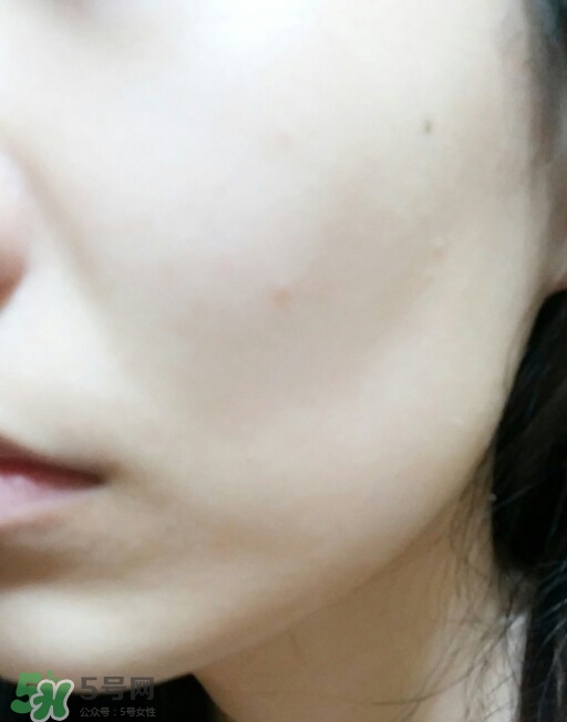 美迪惠爾和麗得姿哪個好 美迪惠爾和麗得姿區(qū)別 美迪惠爾和麗得姿哪個好 美迪惠爾和麗得姿區(qū)別