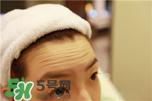 抬頭紋是什么?抬頭紋是怎么產(chǎn)生的? 抬頭紋是什么?抬頭紋是怎么產(chǎn)生的?