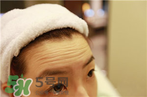 抬頭紋怎么去除?抬頭紋怎么避免? 抬頭紋怎么去除?抬頭紋怎么避免?