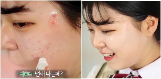 real skin patch怎么樣？real skin是什么牌子