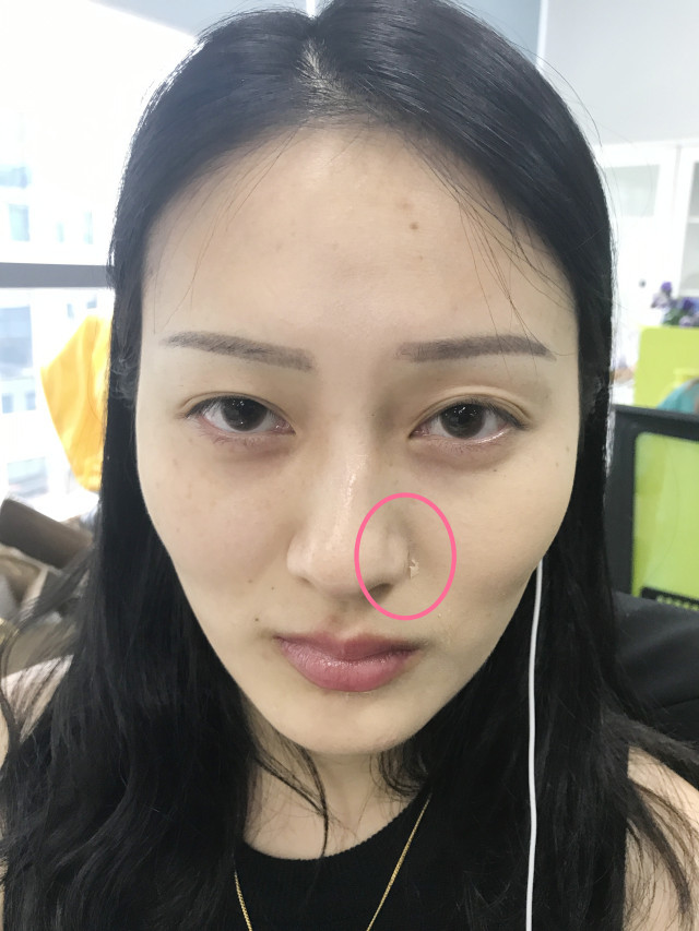real skin patch怎么樣？real skin是什么牌子