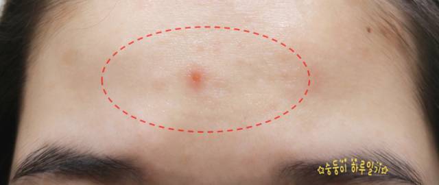 real skin patch怎么樣？real skin是什么牌子