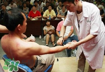 刮痧痛嗎？刮痧疼還是拔罐疼