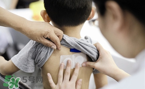 三伏灸有什么作用？三伏灸不能吃什么