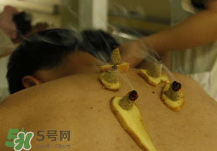 三伏灸有用嗎？2017年三伏艾灸時間