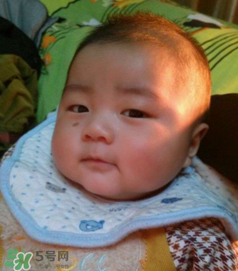 寶寶胎記什么時候去掉？寶寶胎記什么時候去掉最好？