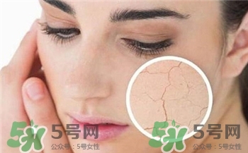 敷面膜有刺痛感是怎么回事?敷面膜有辣辣的感覺 敷面膜有刺痛感是怎么回事?敷面膜有辣辣的感覺