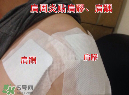 艾灸貼多少錢一盒?？艾灸貼一盒60裝多少錢？