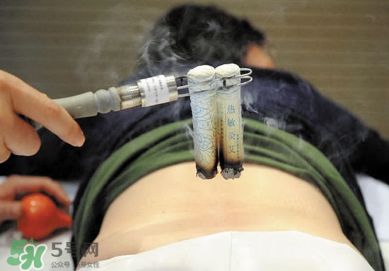 艾灸多少錢一次？艾灸調理價目表