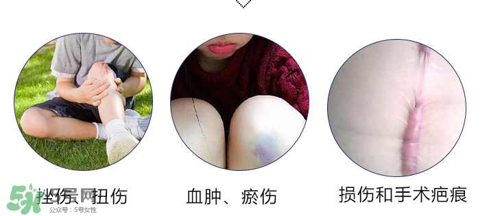 hirudoid除疤膏有效嗎？hirudoid去疤膏效果如何？