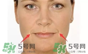嘴角紋是什么?嘴角紋是怎么形成的? 嘴角紋是什么?嘴角紋是怎么形成的?