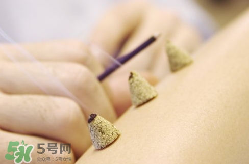 三伏貼和艾灸哪個(gè)好？三伏貼和艾灸區(qū)別