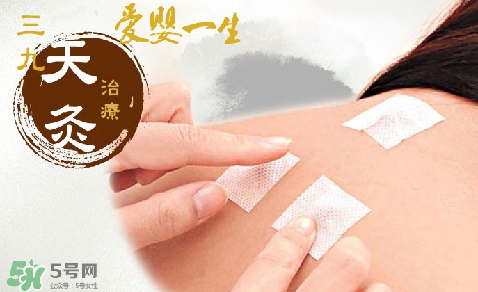 貼三伏貼掛什么科？三伏貼掛什么號？