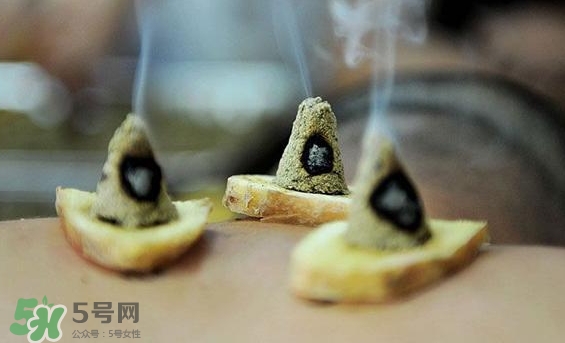 貼三伏貼可以艾灸嗎？貼三伏貼多久可以艾灸