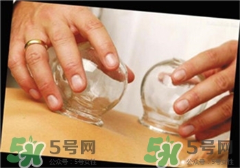 拔火罐有水泡是為什么?水泡要怎么處理? 拔火罐有水泡是為什么?水泡要怎么處理?