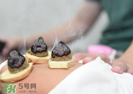 三伏灸什么人不能做？三伏灸適合哪些人？