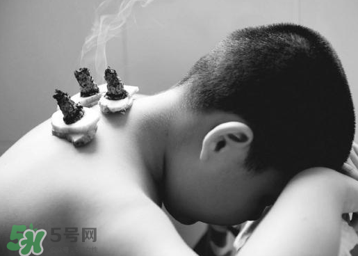 三伏灸什么人不能做？三伏灸適合哪些人？