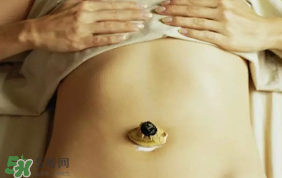 艾灸貼可以貼肚臍眼嗎？艾灸貼貼肚臍的功效