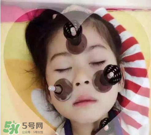 艾灸貼可以治咳嗽嗎？艾灸貼可以治退燒嗎？