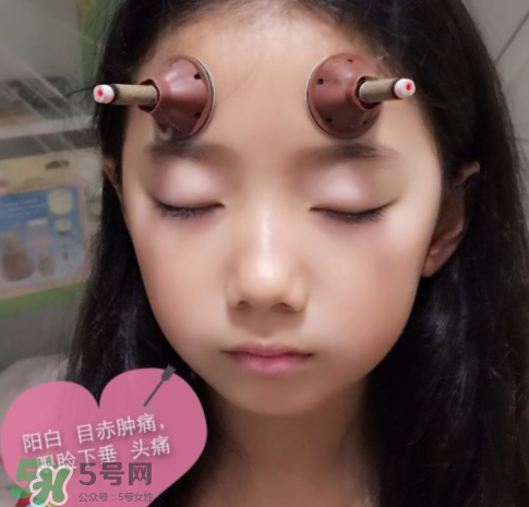 艾灸貼可以治咳嗽嗎？艾灸貼可以治退燒嗎？