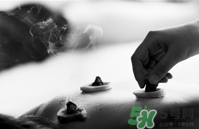 三伏灸什么時候開始灸？三伏灸怎么灸？