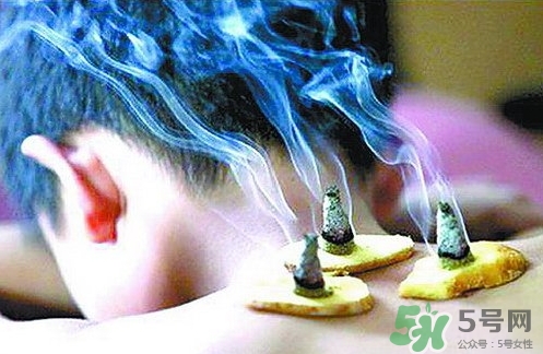 三伏灸什么時候開始灸？三伏灸怎么灸？