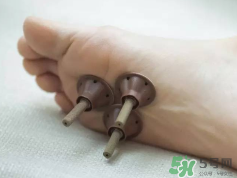 艾艾貼灸出水珠為什么？艾艾貼后有水珠要擦嗎？