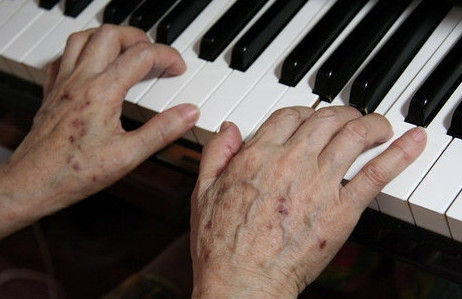 為什么人老了會(huì)長老年斑？老年斑是什么原因引起的