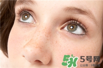 黃褐斑能徹底去除嗎?黃褐斑怎么祛除? 黃褐斑能徹底去除嗎?黃褐斑怎么祛除?