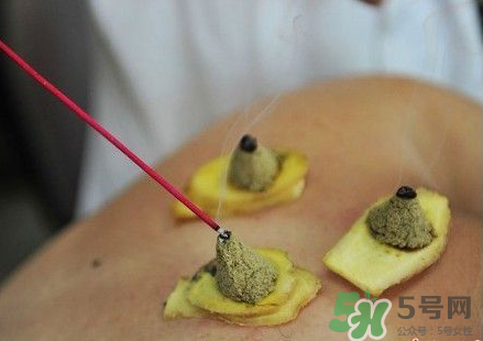 三伏灸可以自己灸嗎？三伏灸可以在家做嗎？