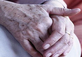 老年斑多大年齡開始有？為什么牙膏能去老年斑？