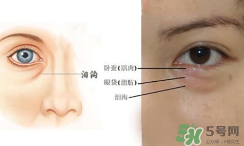 淚溝能自己恢復嗎？淚溝怎么自己恢復？