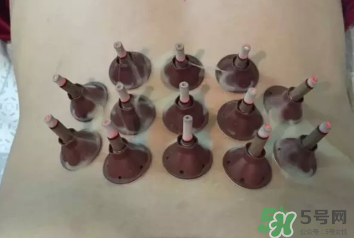 艾艾貼可以貼肚臍眼嗎？艾艾貼貼肚臍有什么作用？