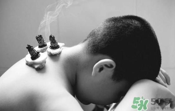 三伏灸要灸幾次？三伏灸要灸多久？