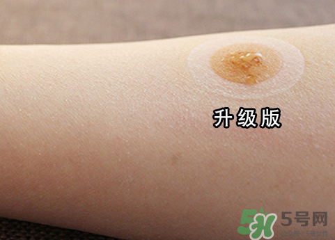 艾灸貼后有水泡怎么辦？貼艾灸貼應(yīng)注意些什么？