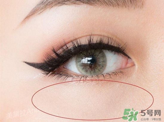 玻尿酸填充淚溝多久恢復(fù)自然？玻尿酸填充淚溝的危害