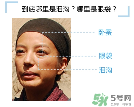 玻尿酸填充淚溝多久恢復(fù)自然？玻尿酸填充淚溝的危害