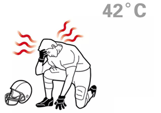 熱射病為什么不能喝水？熱射病為什么會抽搐