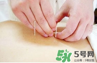 什么人不能做放血療法？放血療法有什么功效？