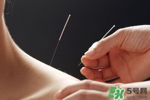 針灸能治療哪些??？古代針灸用具是幾針