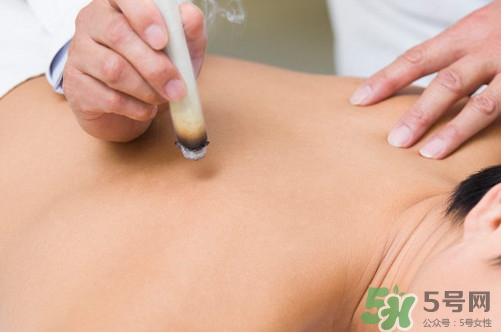 三伏灸一次做多長(zhǎng)時(shí)間？三伏灸用新生姜好還是老的好