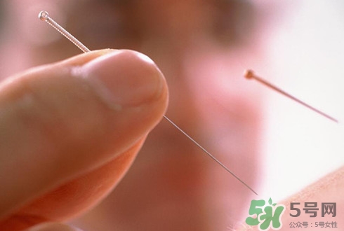 針灸可以治療失眠嗎？失眠時(shí)針灸哪些穴位有效