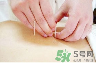 放血療法治中風靠譜嗎？放血療法主要針對什么樣的病