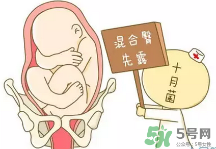 胎位不正能順產(chǎn)嗎？胎位不正怎么辦？