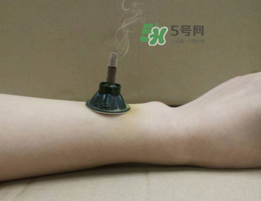 三伏天下雨可以艾灸嗎？三伏天下雨艾灸好嗎？