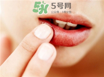 唇色深怎么辦?唇色深怎么改善? 唇色深怎么辦?唇色深怎么改善?