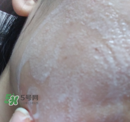 貝蜜清凈痘控油潔面啫喱怎么樣？貝蜜清祛痘控油潔面啫喱好用嗎？