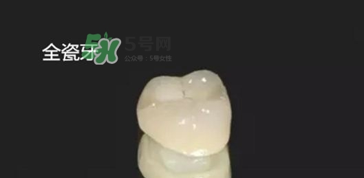 烤瓷牙和全瓷牙有什么區(qū)別?烤瓷牙和全瓷牙的區(qū)別 烤瓷牙和全瓷牙有什么區(qū)別?烤瓷牙和全瓷牙的區(qū)別