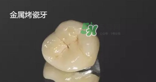 烤瓷牙和全瓷牙有什么區(qū)別?烤瓷牙和全瓷牙的區(qū)別 烤瓷牙和全瓷牙有什么區(qū)別?烤瓷牙和全瓷牙的區(qū)別